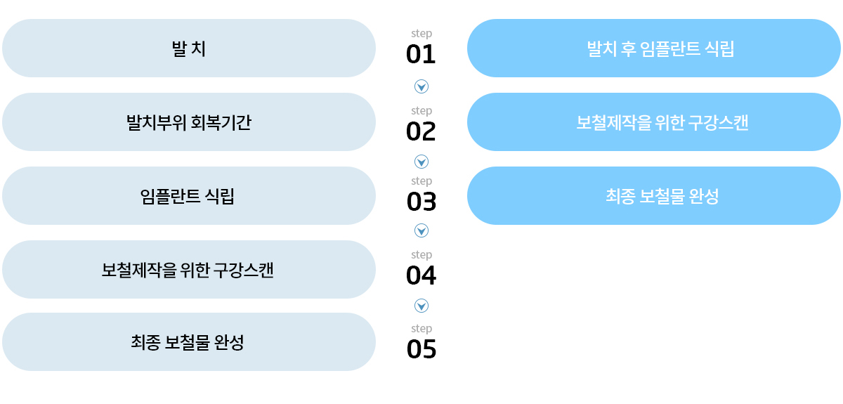 일반임플란트발치즉시임플란트비교표